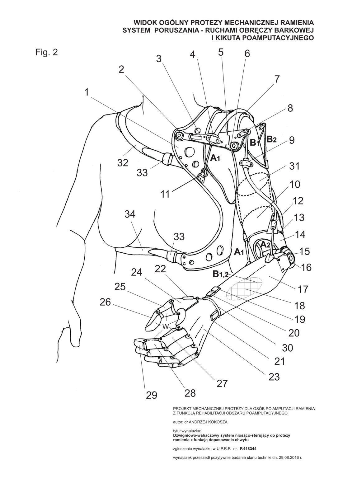 A.Kokosza, projekt społeczny RZEŹBA DLA RZEŹBIARKI, 2015-2020, fot. Agnieszka Krassowska